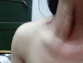 揪脖子痧视频,轻松缓解颈部酸痛的神奇疗法